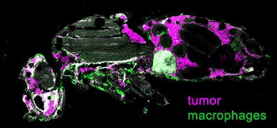 A_study_of_brain_tumor_progression_in_a_Drosophila