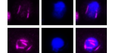 Revealing_the_structure_and_function_of_a_cytoskel