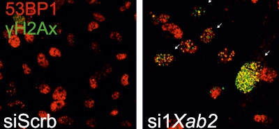 The_splicing_factor_XAB2_interacts_with_ERCC1-XPF_
