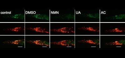 Mitophagy_inhibits_amyloid-β_and_tau_pathology_an