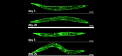 Maintenance_of_Proteostasis_by_P_Body-Mediated_Reg