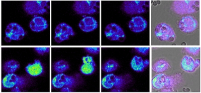 Calcium_sequestration_by_fungal_melanin_inhibits_c