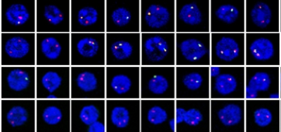 Long_noncoding_RNAs_regulate_allelic_gene_expressi