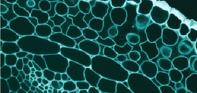 bHLH-O_proteins_are_crucial_for_Drosophila_neurobl