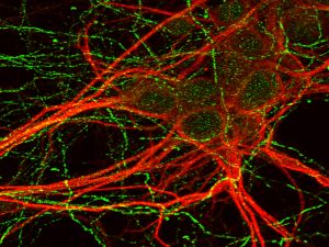 IMBB-FORTH_Researchers_reveal_how_stress_and_nutri